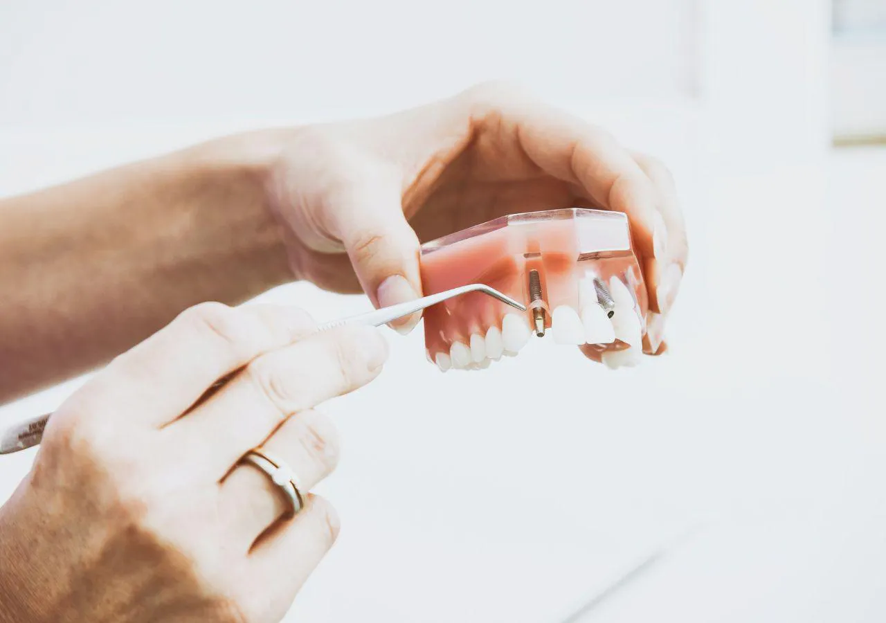 Implantes y carga inmediata en el día